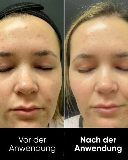 PeelShot™ | Rice Glow Serum (80ml)