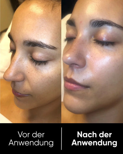PeelShot™ | Rice Glow Serum (80ml)