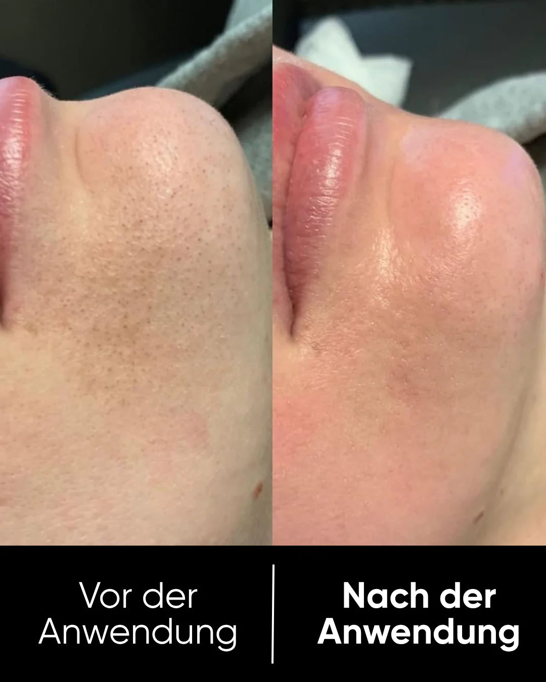 PeelShot™ | Rice Glow Serum (80ml)